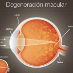 degeneracion-macular